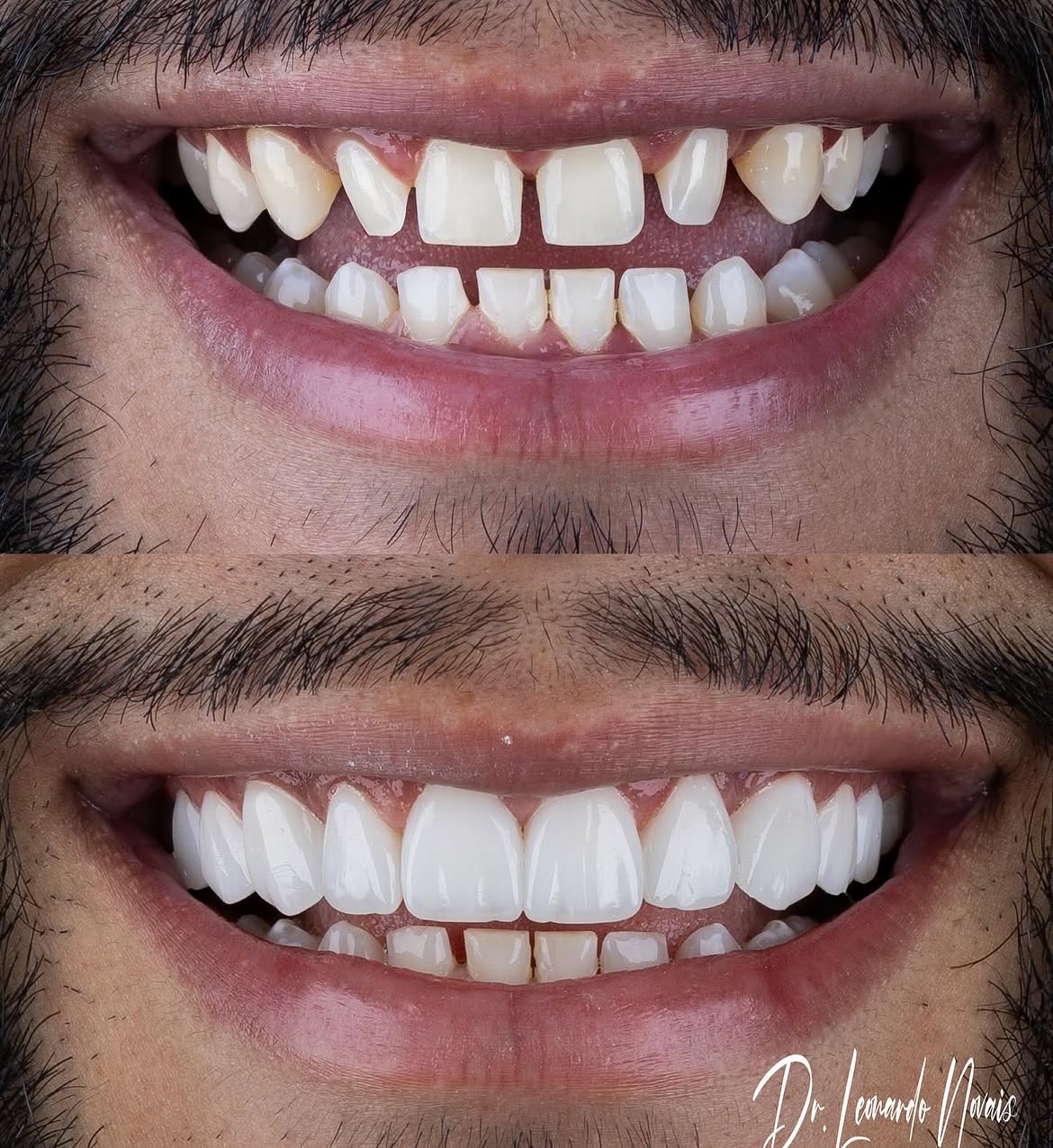 Antes e depois — caso 3